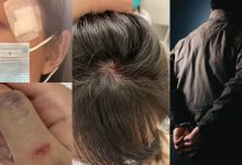 无人机击中女子案后续 警方拘捕33岁男子-航拍网